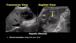 liver ultrasound reporting [upl. by Kassaraba665]