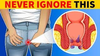 6 Signs of Colon Cancer You Should Know [upl. by Mudenihc]