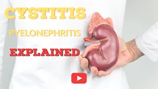 What is Cystitis  Cystitis Explained [upl. by Gretta507]