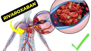 Rivaroxaban The Game Changing Anticoagulant Thats Revolutionizing Medical Treatment [upl. by Forcier]