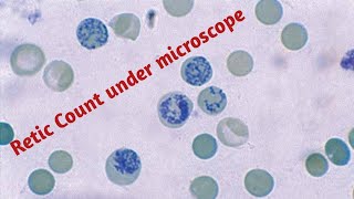 Reticulocyte  Reticulocyte count test in hindi [upl. by Shirlene]