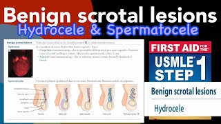 Benign scrotal lesions Hydrocele amp Spermatocele in HindiUrdu by first aid for USMLE step 1 [upl. by Yelkcub469]