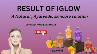 RESULT OF IGLOW  A NATURAL  AYURVEDIC SKINCARE SOLUTION [upl. by Lyrej]