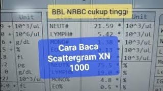 Cara Baca Scattergram Histogram Hematology Analyzer 6 Diff XN 1000 [upl. by Olnton]