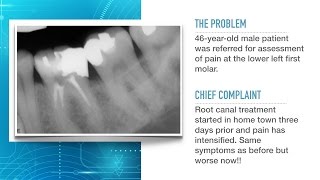 Advances in Endodontic Treatment Part 1Diagnosis and Treatment Planning [upl. by Eitnom]