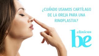 Cuándo usamos cartílago de oreja para una rinoplastia o cirugía nariz  Clínicas Be [upl. by Eecyaj]