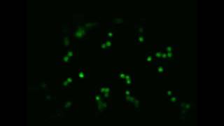 GFP  Golgi bodies in a plant cell [upl. by Shadow]