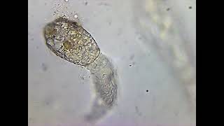 Rotifer with head stuck in Amoebas test [upl. by Eissen]