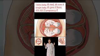 Twins baby ki lambai or wajan me single baby ki tulna me kitna antar rhta h pregnancy me twins baby [upl. by Leach88]