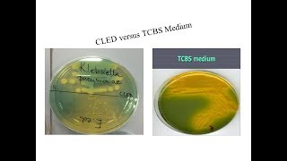 various bacterial growth in CLED and TCBS [upl. by Zondra]