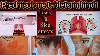 Prednisolone tablets use in hindi  Dosage  Side effects  drug interactions  contraindications [upl. by Ydurt159]