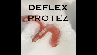 DEFLEX DİŞ PROTEZİ [upl. by Jada]