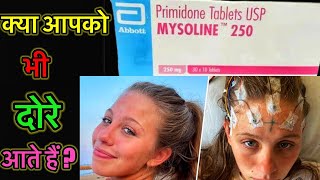 Primidone Tablet  Mysoline Tablet  Epilepsy  Fits  दोरे  जानिए पूरी इन्फ़ॉर्मेशन इस विडियो में [upl. by Nevile]