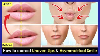 How to correct Uneven Lips Crooked Lips Asymmetrical smile by Facial amp Lips Exercises [upl. by Astred]