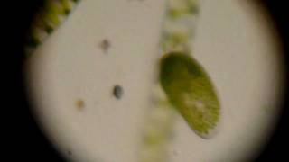 Paramecium bursaria with zoochlorellae [upl. by Kinsley]