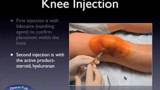 Knee injection web [upl. by Acinorev802]