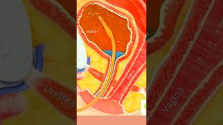 Urethral Catheter Insertion 🤯 shortvideo share status and [upl. by Petersen]