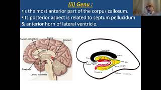 Commissural fibres amp corpus callosum [upl. by Eerised656]