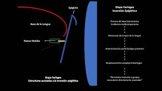 Inversión Epiglótica [upl. by Gmur]