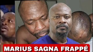 ⛑Urgence Les cicatrices visibles de lagression de Guy Marius Sagna au Togo [upl. by Ofella]