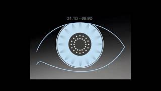 Tip Instructional – Eyesuite Biometry Keratometry [upl. by Teodoor]