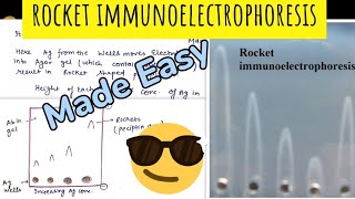 Rocket Immunoelectrophoresis😎😎Made Easy 🤩 [upl. by Tehr]