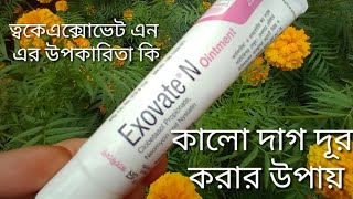 Exovate N ointmentত্বক ফর্সা করবে কিনা  Exovate N ointment ত্বকে এর কাজ কি [upl. by Enidan108]