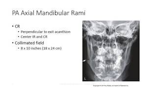 Radiographic Positioning of the Mandible [upl. by Walston]