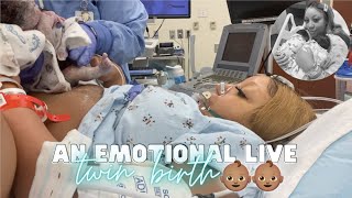 THE LIVE BIRTH OF OUR SECOND SET OF TWINS  Real Raw amp Emotional Doctor Turns Breech Baby in Womb [upl. by Eerrehs]