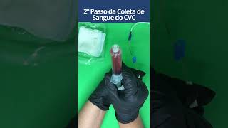 COMO COLETAR SANGUE DO CVC PARTE 02 shortsvideo enfermagem [upl. by Airdnat534]