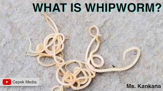 What is Whipworm  Biotechnology  General Medicine [upl. by Viens]