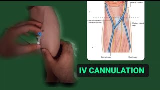 IV CANNELTON 😍  NURSESCOPE [upl. by Gery]