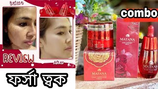 matana whitening combo  matana serum amp matana night cream review  khadija begum bhb tips Shajgoj [upl. by Ennyrb]