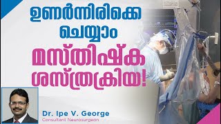 What is Awake Craniotomy Talk by Dr Ipe V George Caritas Hospital Kottayam [upl. by Asaert]