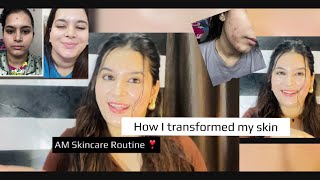 Honest AM skincare Routine 🥰for glass skin acne acnetransformation honestreview honestskincare [upl. by Oicnerolf]