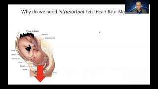 Physiological Interpretation of Cardiotocograph CTG  Paradigm Shift Part 1 [upl. by Pammi758]