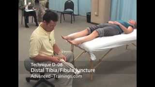 Ankle FibulaTibia Syndesmosis  Advanced Myofascial Techniques DVD Series [upl. by Rudiger]