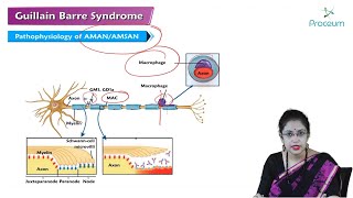 Guillain Barre Syndrome Hindi  Internal Medicine [upl. by Dinah922]