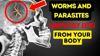 Only 2 Spoons Expels All Worms and Parasites from your Body  7Day Natural Parasite Cleanse viral [upl. by Yrrab699]