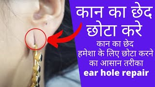 कान का छेद हमेशा के लिए छोटा करने का आसान तरीका  ear hole repair  ear hole closing without surgery [upl. by Gschu]