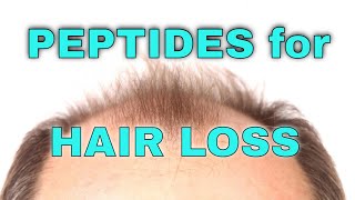 Peptides for Hair Loss [upl. by Ycniuqed]