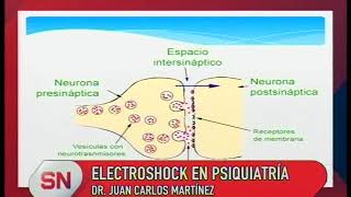 ELECTROSHOCK EN PSIQUIATRÍA [upl. by Aratehs877]