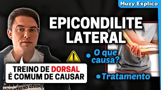 EPICONDILITE LATERAL DO COTOVELO  Muzy Explica [upl. by Anined]