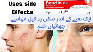 Benclin gel how to uses review  benclin gel uses in urdu سکن پر کیل مہاسے چھائیاں ختم [upl. by Bearce]