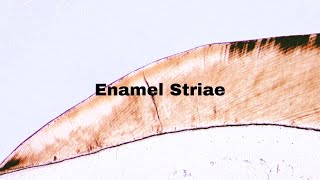 Enamel Striae  Incremental lines of retzius  Dentistry Oral Histology 🔬 [upl. by Baptista]