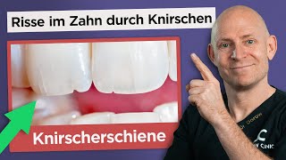 Die richtige Knirscherschiene gegen Zähneknirschen Bruxismus [upl. by Laurianne113]