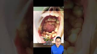 Muela enterrada dientes dentista tips parati viral fyp shorts shortvideo fypシ [upl. by Are24]