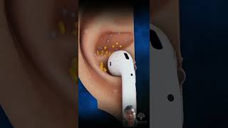 doctor skincare chiropractic ear chiropractor earwaxcleaning [upl. by Abeh879]