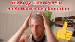 Haartransplantation Haare waschen nach OP [upl. by Uhn]