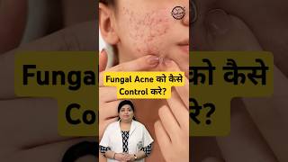 How to treat Fungal Acne on face  Fungal Acne Treatment fungalacne acne skincare shorts [upl. by Gredel]